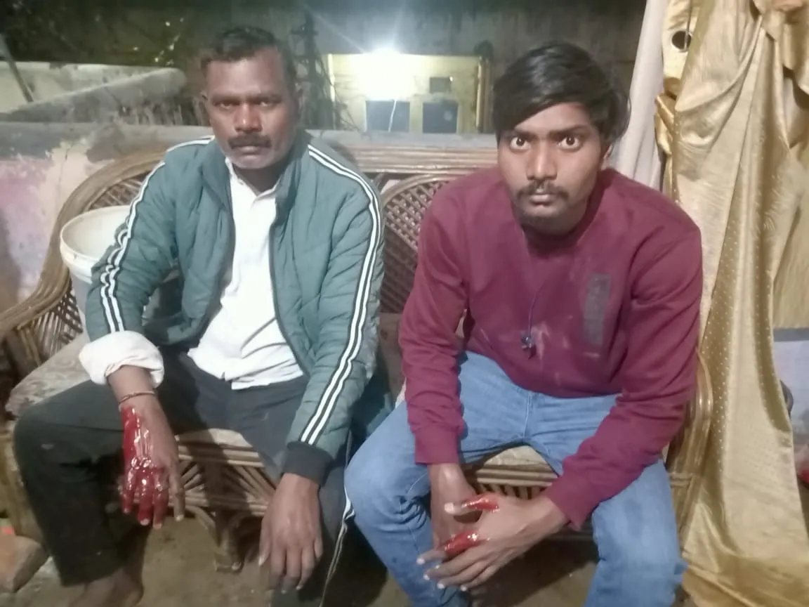 बरेली: खाना बनाते समय सिलेंडर में लगी आग से दो झुलसे, मोबाइल दुकान में आग से लाखों का नुकसान