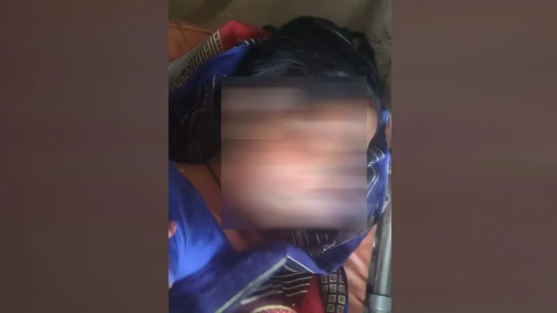 हरदोई में जंगली जानवर की दहशत-महिला समेत तीन लोगों पर किया हमला  