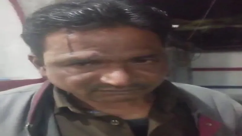 प्रयागराज: हेड कांस्टेबल ने टार्च से वार फोड़ा  होमगार्ड की सिर, जाने पूरा मामला