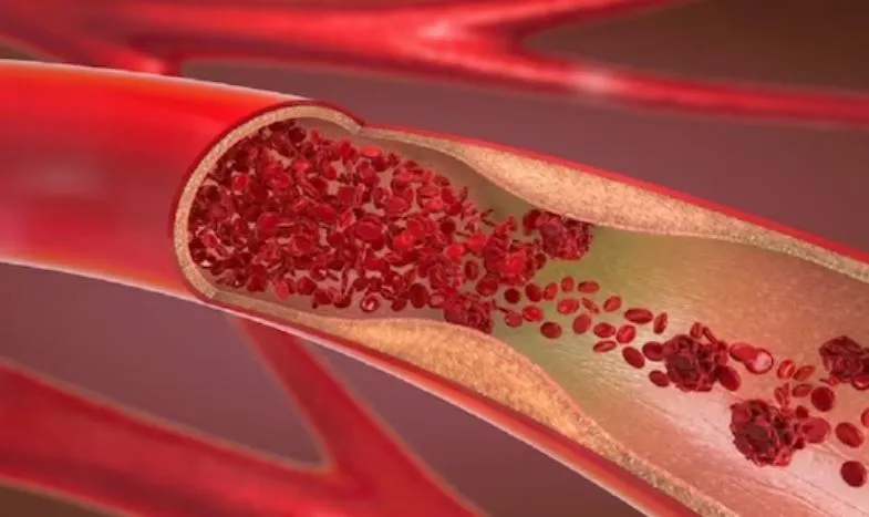 नसों की ब्लॉकेज से हैं परेशान... माइंड में घूम रहे कई सवाल?, विशेषज्ञ देंगे निशुल्क परामर्श 