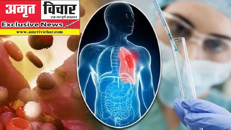 Exclusive: गुटखा, सिगरेट न शराब...फिर भी कैंसर के हुए शिकार, जेके कैंसर संस्थान में पीड़ित मरीजों की भरमार, ऐसे केस आ रहे सामने