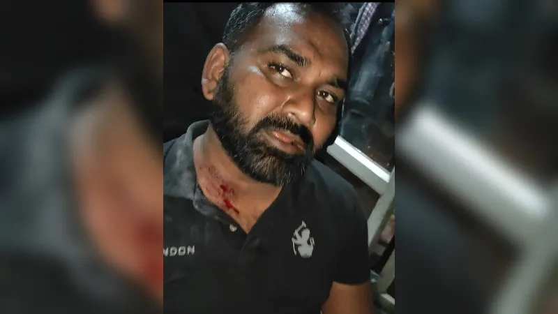 Kanpur News: ग्वालटोली में मीट व्यापारी पर चलाई गोली; घायल, घटना सीसीटीवी में कैद, दो आरोपी गिरफ्तार...