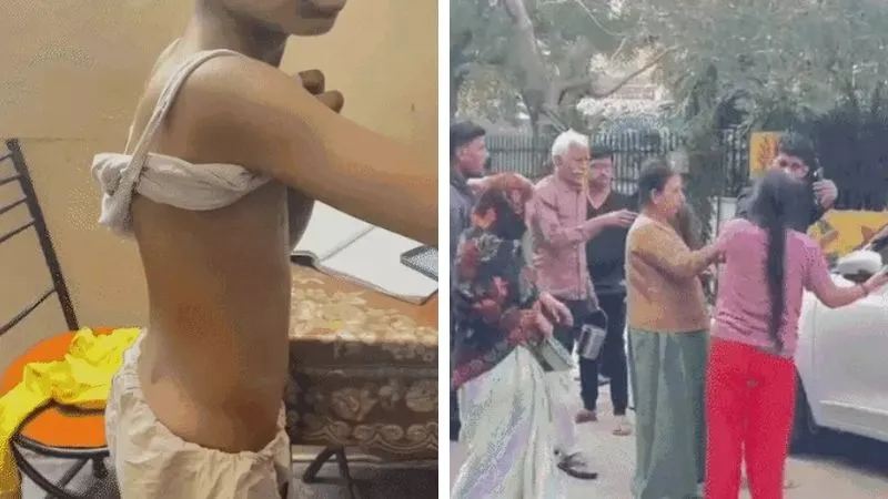 Kanpur News: बर्रा में कुत्तों ने मासूम बच्चे को कई जगह काटा, पूरी घटना CCTV में कैद