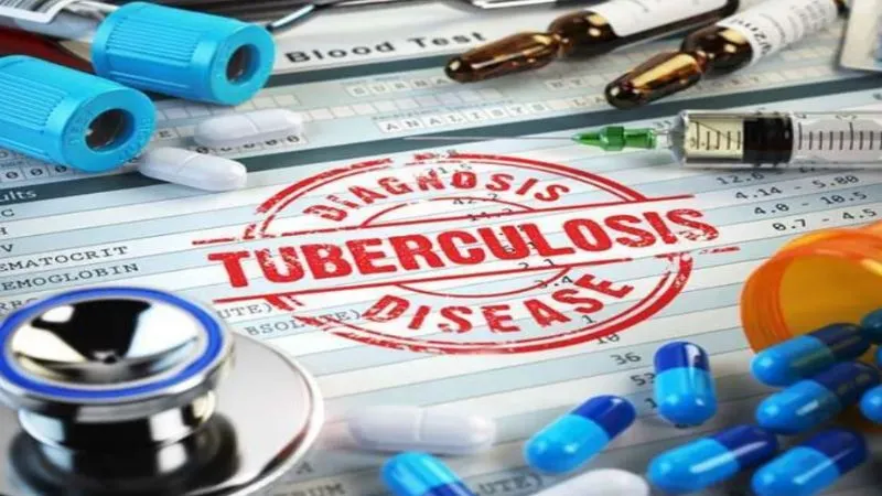 Kanpur News: घनी आबादी व मालिन बस्तियां टीबी बैक्टीरिया के घर...चौंकाने वाले आकंड़े कर रहे खुलासा