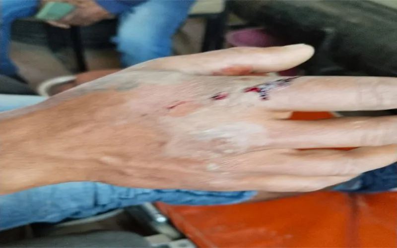 बहराइच: बकाया बिजली बिल वसूलने गए बिजली कर्मियों से ग्रामीणों ने की मारपीट, दौड़ा-दौड़ाकर पीटा, देखें video