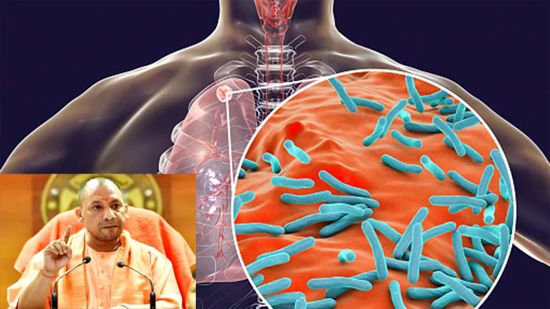 लखनऊ: यूपी में 'टीबी' ने तोड़ा दम, प्रदेश की 33 फीसदी पंचायतों को जानलेवा रोग से मिली मुक्ति!, सीएम के प्रयास ला रहे रंग!