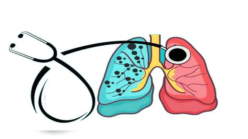 श्रावस्ती: जिले की 15 ग्राम पंचायतें टीबी से मुक्त होने की राह पर, जानिए कैसे मिल रही सफलता? 