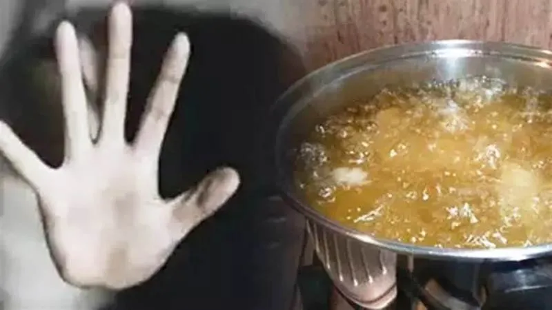 रुद्रपुर: मामूली विवाद के चलते महिला पर फेंका खौलता हुआ तेल