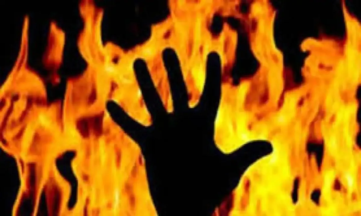 लखनऊ: झोपड़ी में लगी आग, युवक की जलकर मौत
