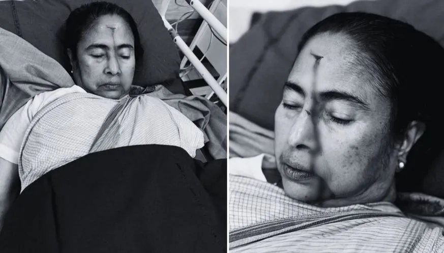 दुर्घटना में पश्चिम बंगाल की सीएम ममता बनर्जी घायल, सिर पर लगी चोट