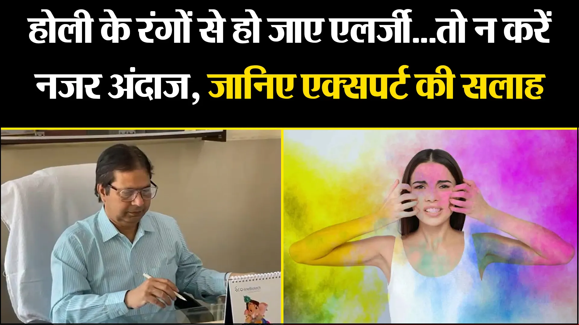 बरेली: होली के रंगों से हो जाए एलर्जी...तो न करें नजर अंदाज, जानिए एक्सपर्ट की सलाह