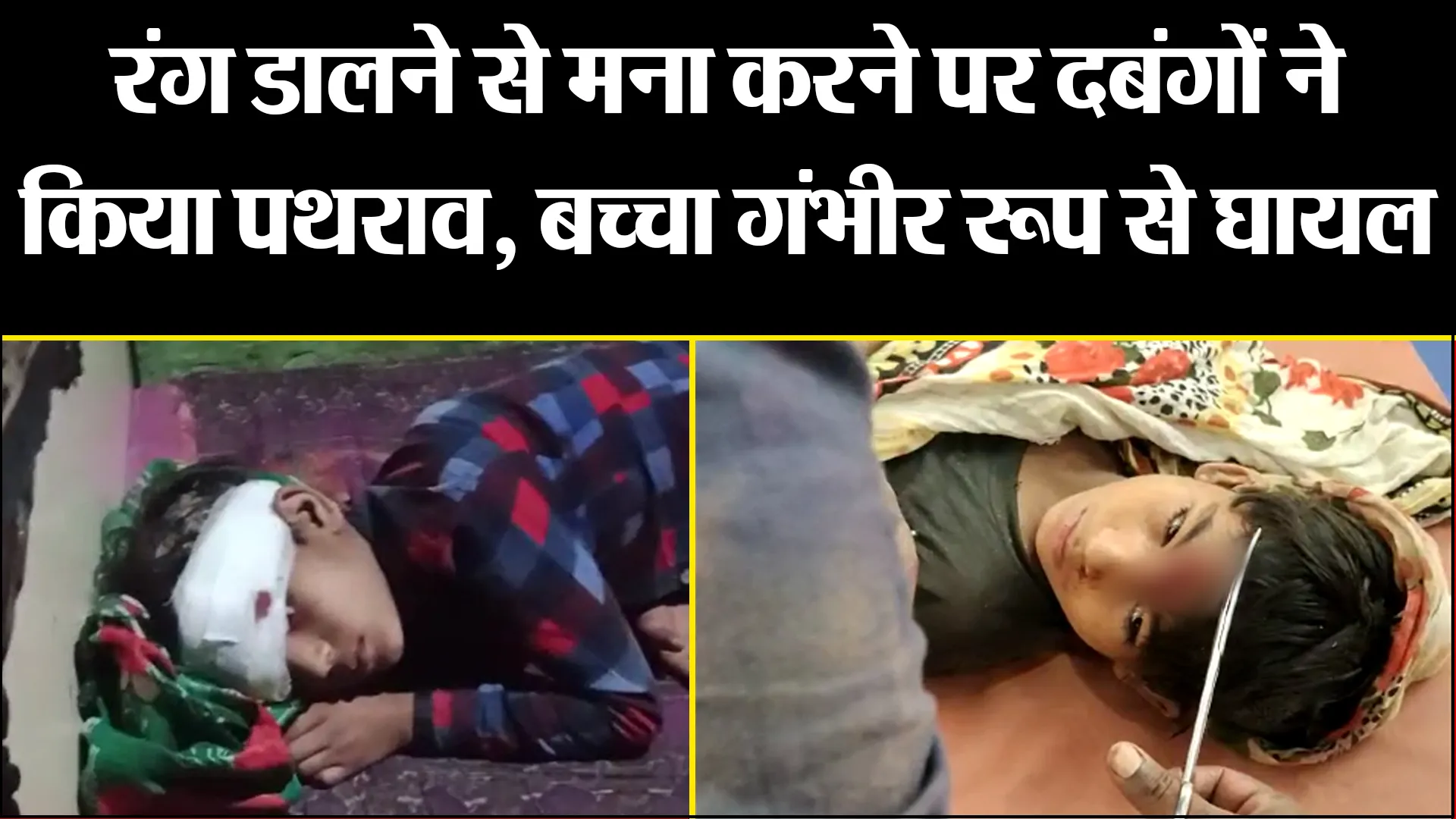 बरेली: रंग डालने से मना करने पर दबंगों ने किया पथराव, बच्चा गंभीर रूप से घायल 