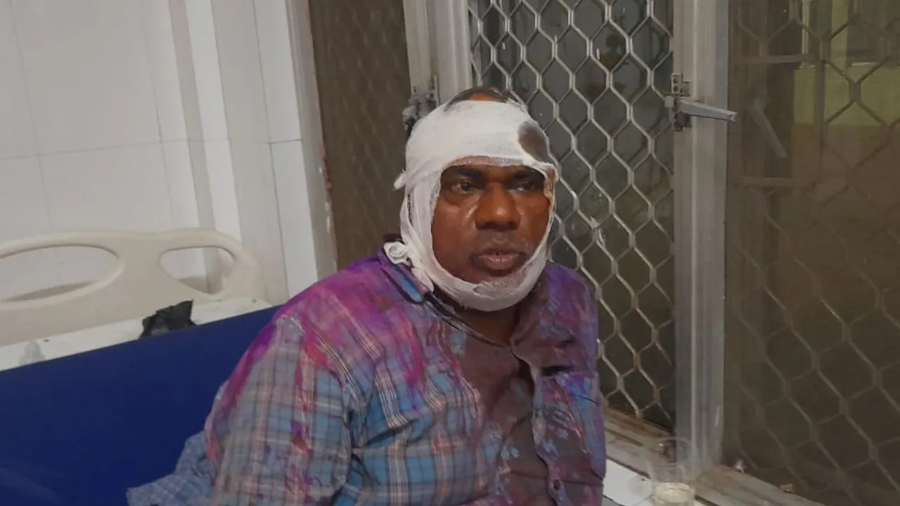 Kannauj: जमीनी विवाद को लेकर दो पक्षों में हुआ खूनी संघर्ष, गोली लगने से एक युवक घायल; अस्पताल में भर्ती