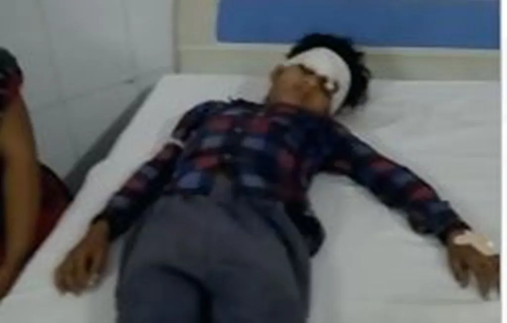 Bareilly News: रंग डालने से मना करने पर दबंगों ने किया पथराव, बच्चा गंभीर रूप से घायल 