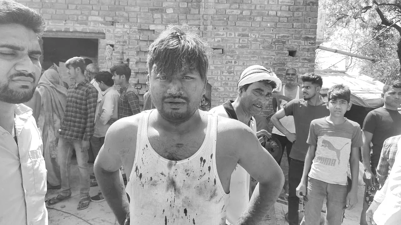 सुलतानपुर: संदिग्ध परिस्थिति में पटाखा कारोबारी के घर लगी आग, पिता-पुत्र झुलसे, बाइक व साइकिल जली 