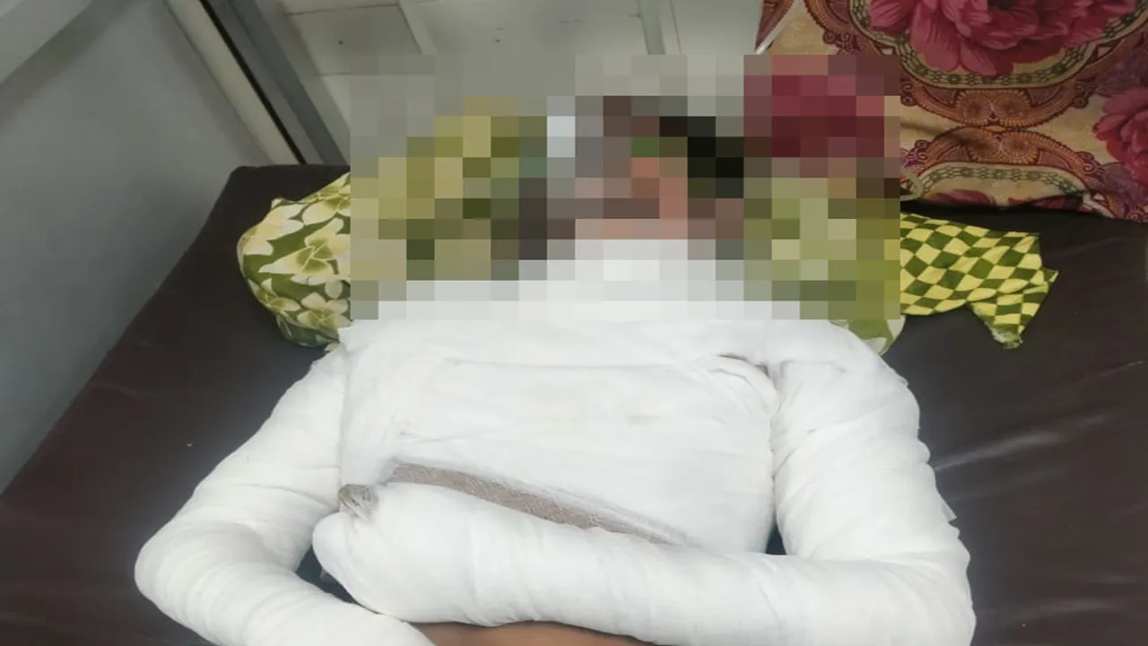 सीतापुर: शादी समारोह में ज़िंदा जला गया युवक, गंभीर हालत में ट्रामा सेंटर में भर्ती 