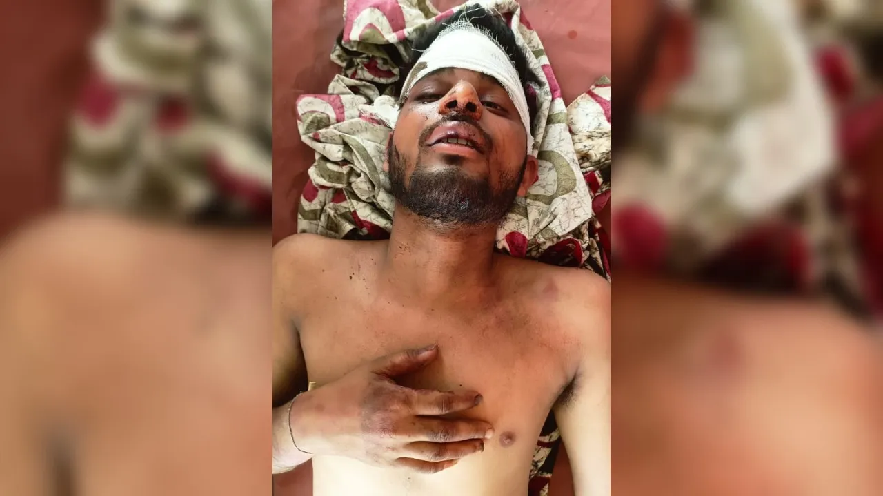 Hamirpur: गर्लफ्रेंड का बुलावा स्वीकार करना युवक को पड़ा महंगा, युवती के परिजनों ने पीट-पीटकर किया मरणासन्न