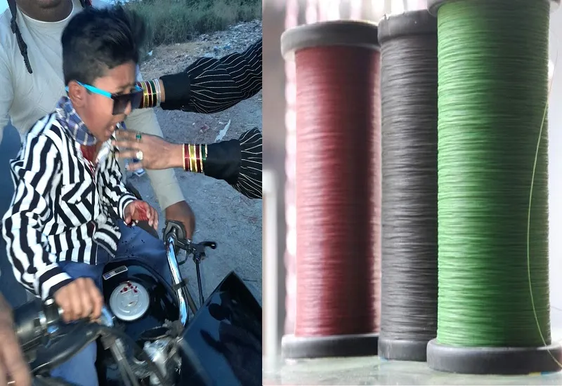 रामपुर : चाइनीज मांझे से कटी सात वर्ष के बच्चे की गर्दन, अस्पताल में भर्ती...लगे 10 टांके  