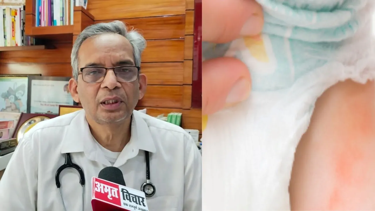  लखनऊ: बच्चों में बीमारी का कारण बन सकता है डायपर, पहनाते समय रहें सावधान