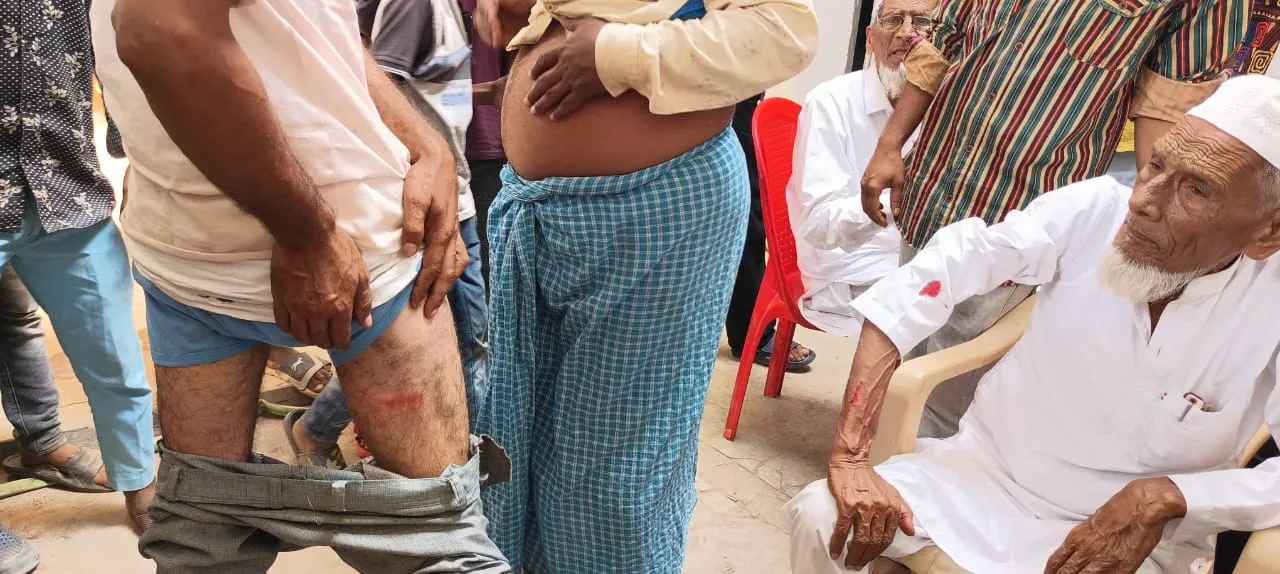 संभल: कई मतदान केंद्रों पर पुलिस ने चलाई लाठी, वोटर चोटिल