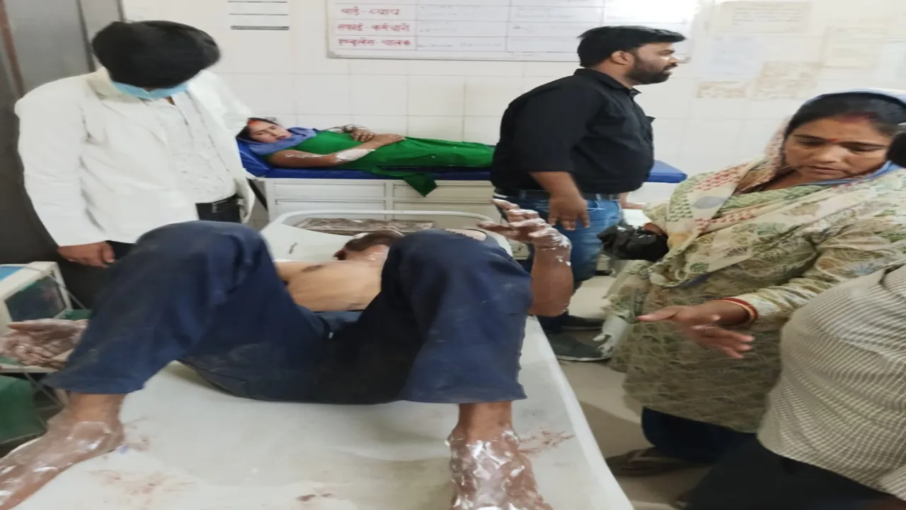 गोंडा: चूल्हा ठीक करते समय गैस सिलेंडर में लगी आग, दंपति झुलसे, पति की हालत गंभीर
