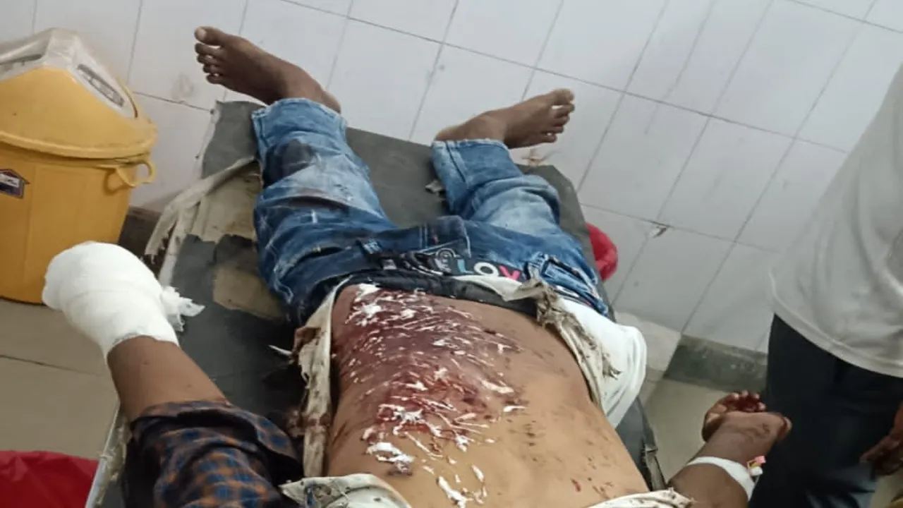 बहराइच: उर्स में गोल दाग रहे नौ लोग हुए घायल, तीन लखनऊ रेफर 