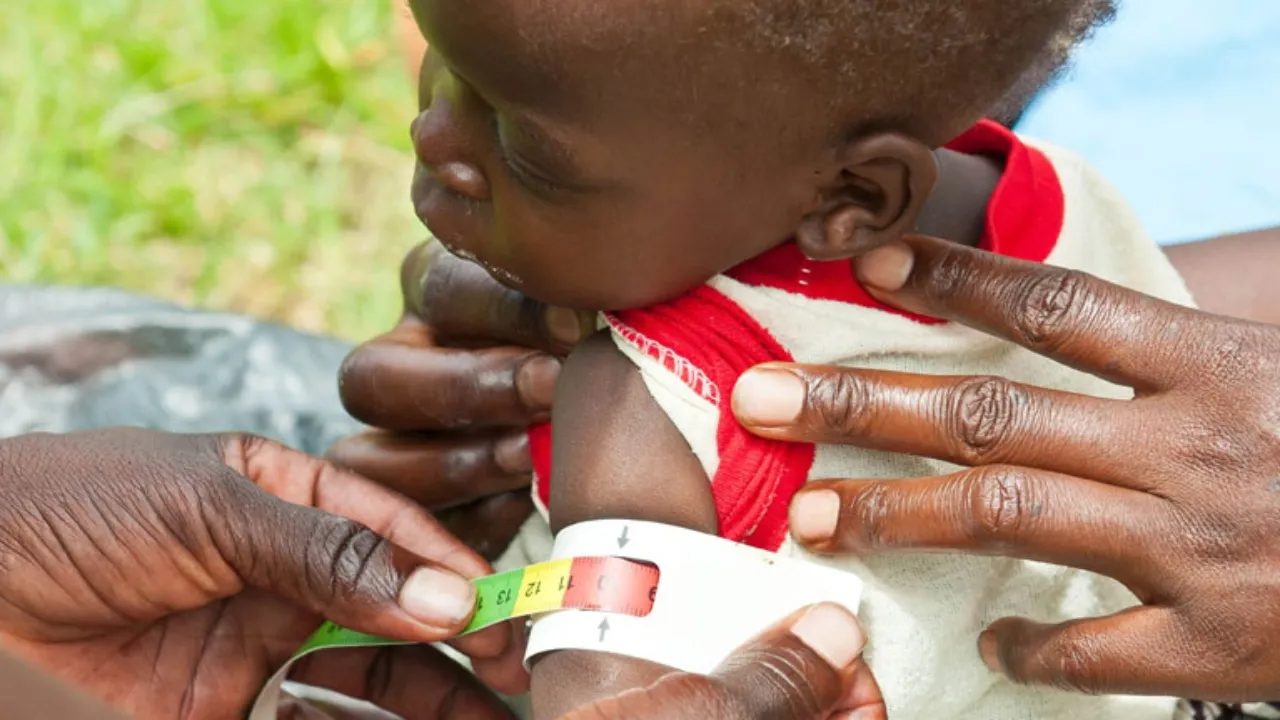 14,970 मासूमों की जिंदगी बर्बाद कर रहा कुपोषण, एनआरसी में भर्ती हैं आठ कुपाेषित बच्चे