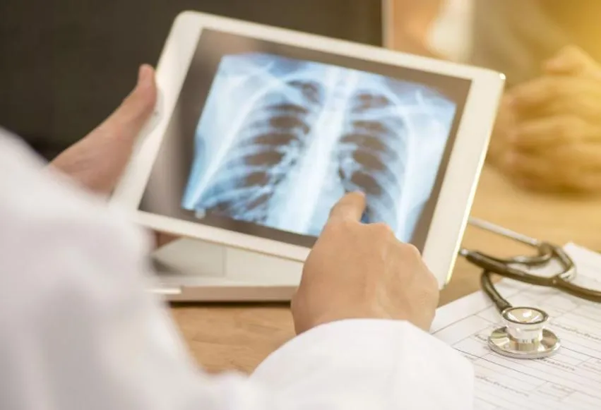 Bareilly News: जागरूकता से जीती मंडल के 69 गांवों में टीबी से जंग