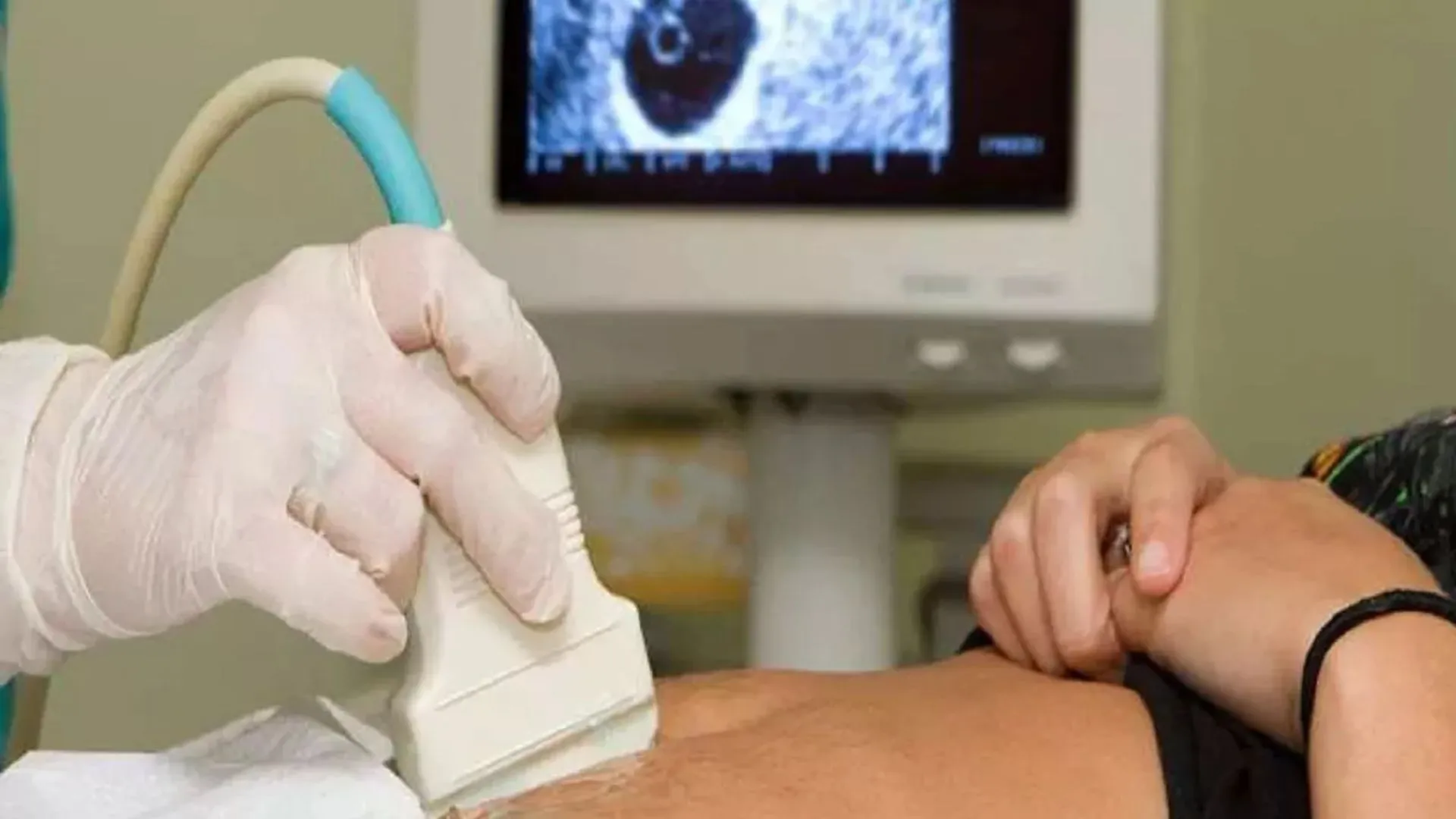 बरेली: अवैध अल्ट्रासाउंड सेंटर पर टीम ने मारा छापा, अस्पताल भी निकला अवैध