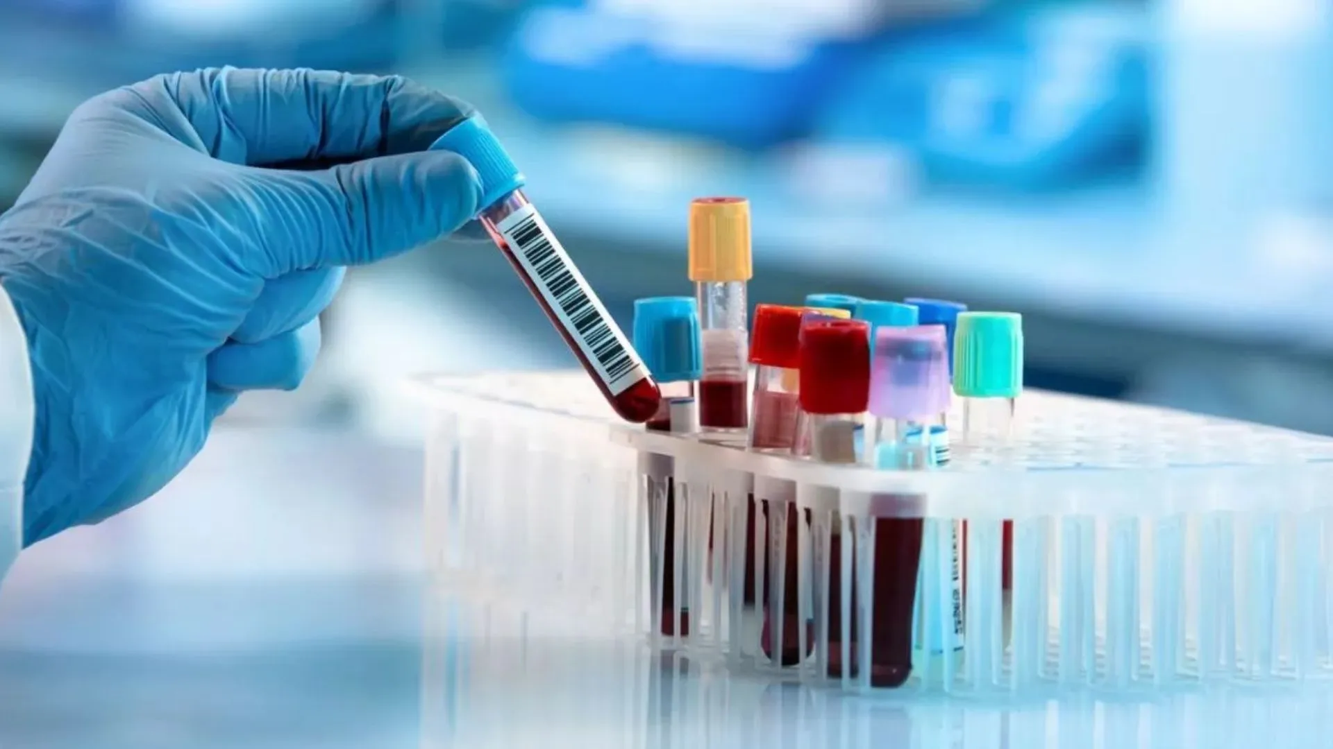 बरेली: स्वास्थ्य विभाग का एक्शन, मीरगंज में अवैध पैथोलॉजी लैब सील 