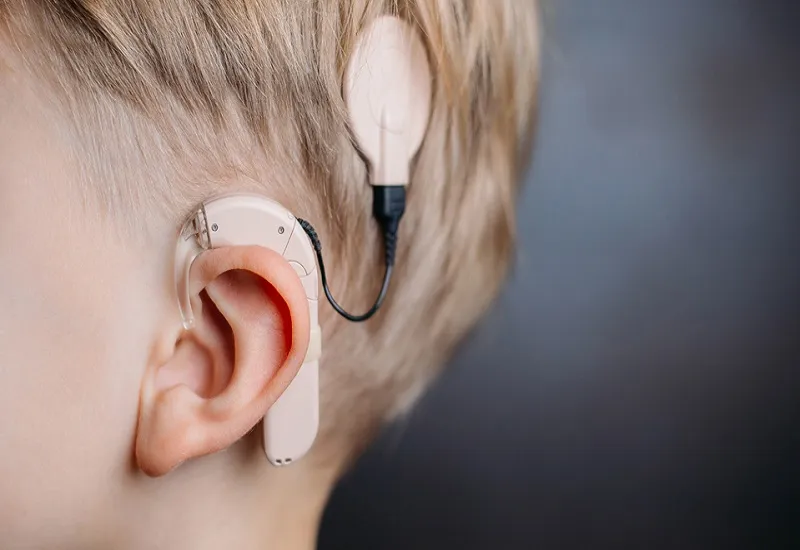 मुरादाबाद : डिवाइस की छिनैती नहीं हुई...टूटी मशीन का एक टुकड़ा ऑटो में मिला...जानें पूरा मामला