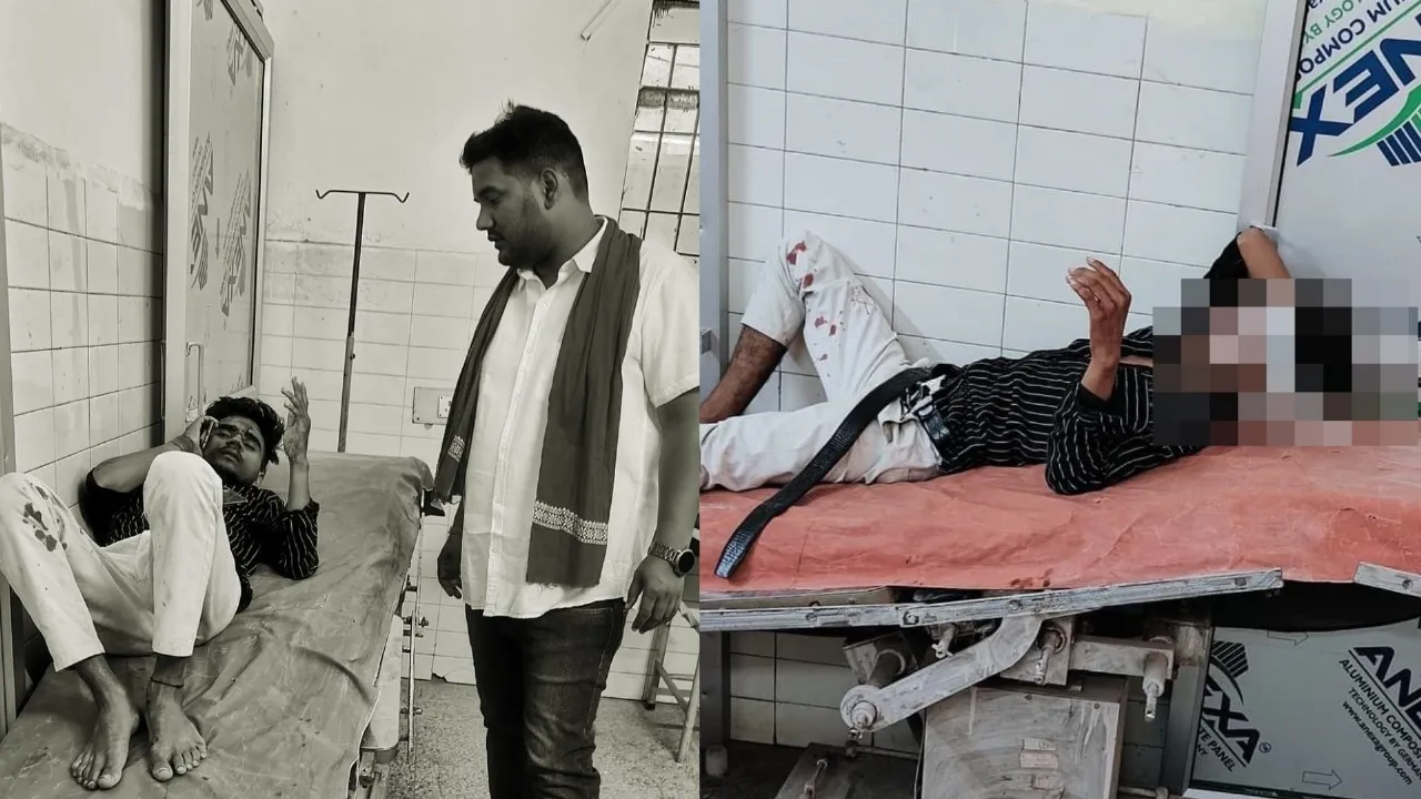 Gonda accident: तेज रफ्तार बाइकों में आमने सामने की भिड़ंत, दो की हालत गंभीर