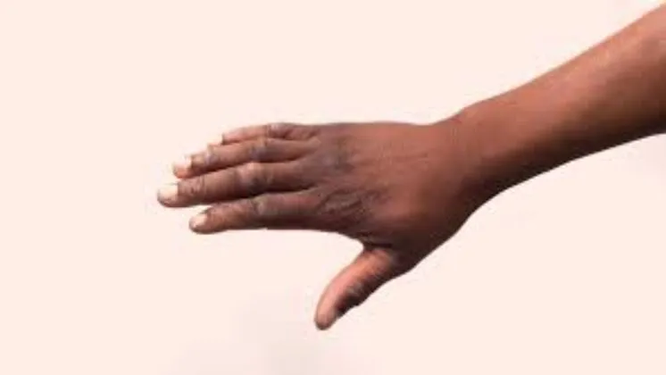 धूप से अगर आपके भी हाथ हो गए काले तो अपनांए ये कुछ घरेलू नुस्खे