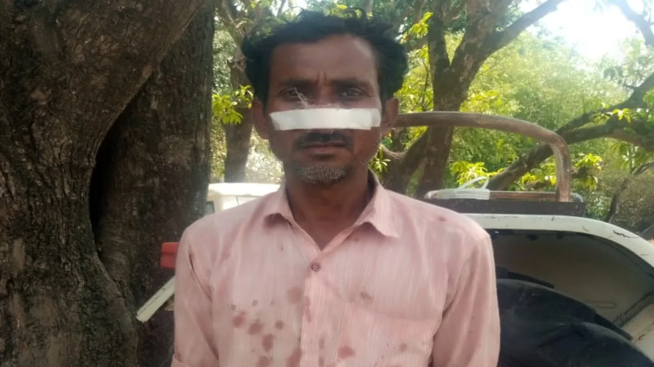 दबंगों ने ग्रामीण की पिटाई कर नाक काटी, बाइक निकालने के लिए साइड मांगने पर किया हमला