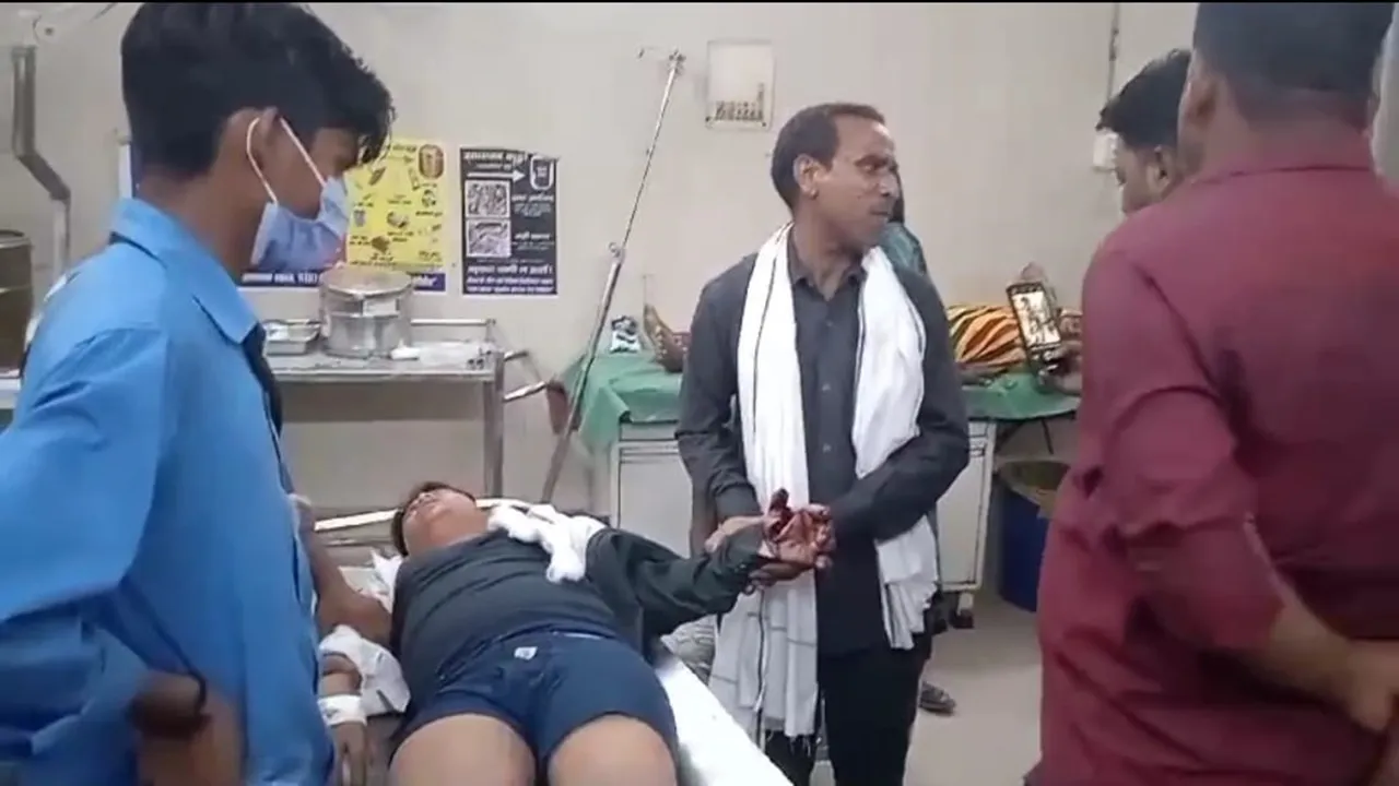 बहराइच: हाथ में गोला दगने से दूल्हे के भाई समेत दो झुलसे