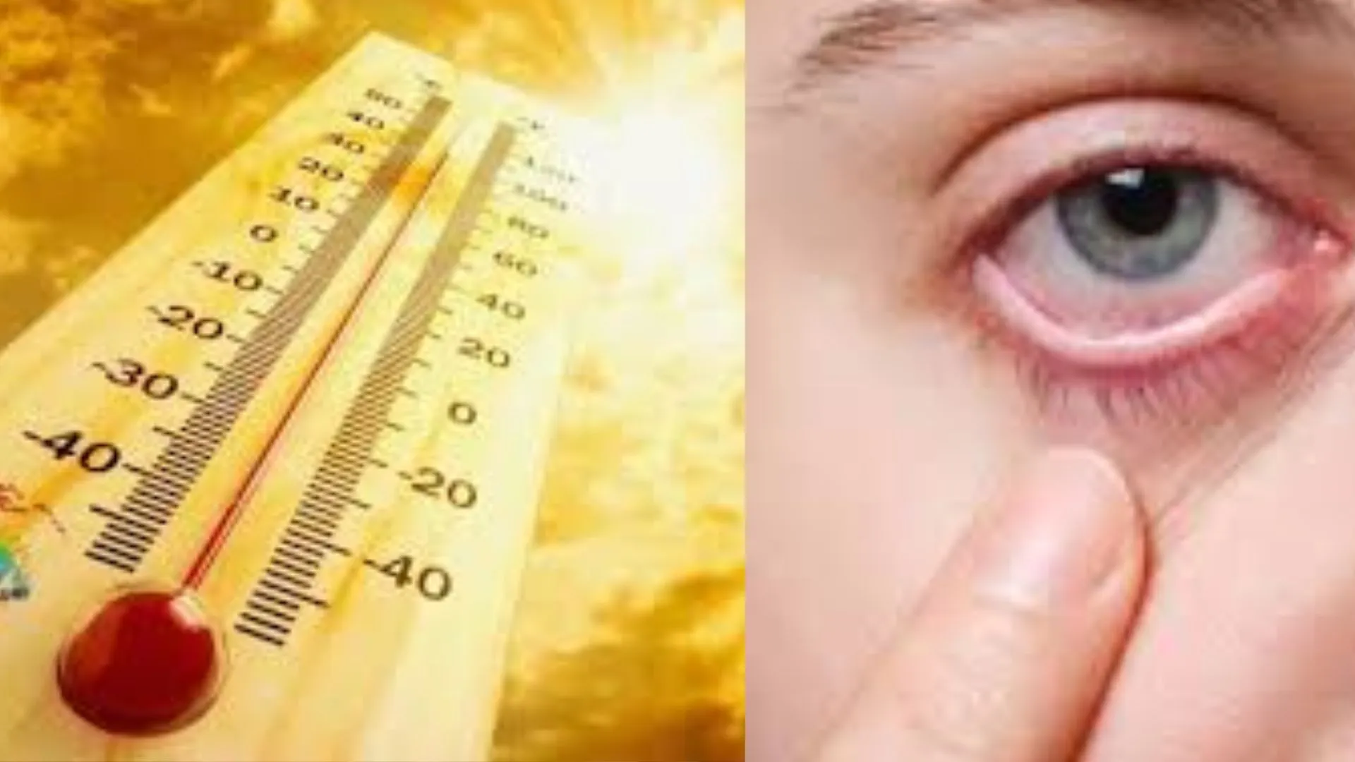 बरेली: गर्मी में आंखों के संक्रमण के मामले बढ़े, डॉक्टरों ने धूप से बचाव की दी सलाह 