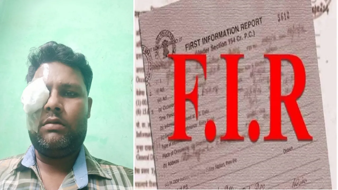 दबंगई: टैक्सी नहीं रोकी तो मनबढ़‌ युवकों ने चालक की पिटाई कर फोड़ दी आंख