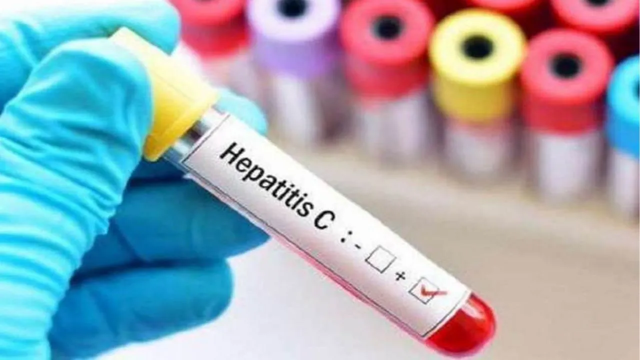 Kanpur: मेडिकल कॉलेज में हेपेटाइटिस बी व सी की होगी मुफ्त जांच, वायरल लोड का ट्रायल शुरू, मरीजों को मिलेगी राहत