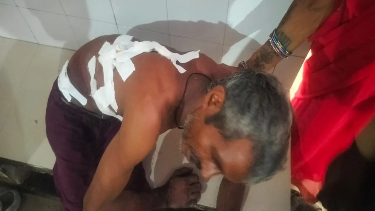 बहराइच में तेंदुए से भिड़ा किसान, संघर्ष कर मुश्किल से बचाई अपनी जान 