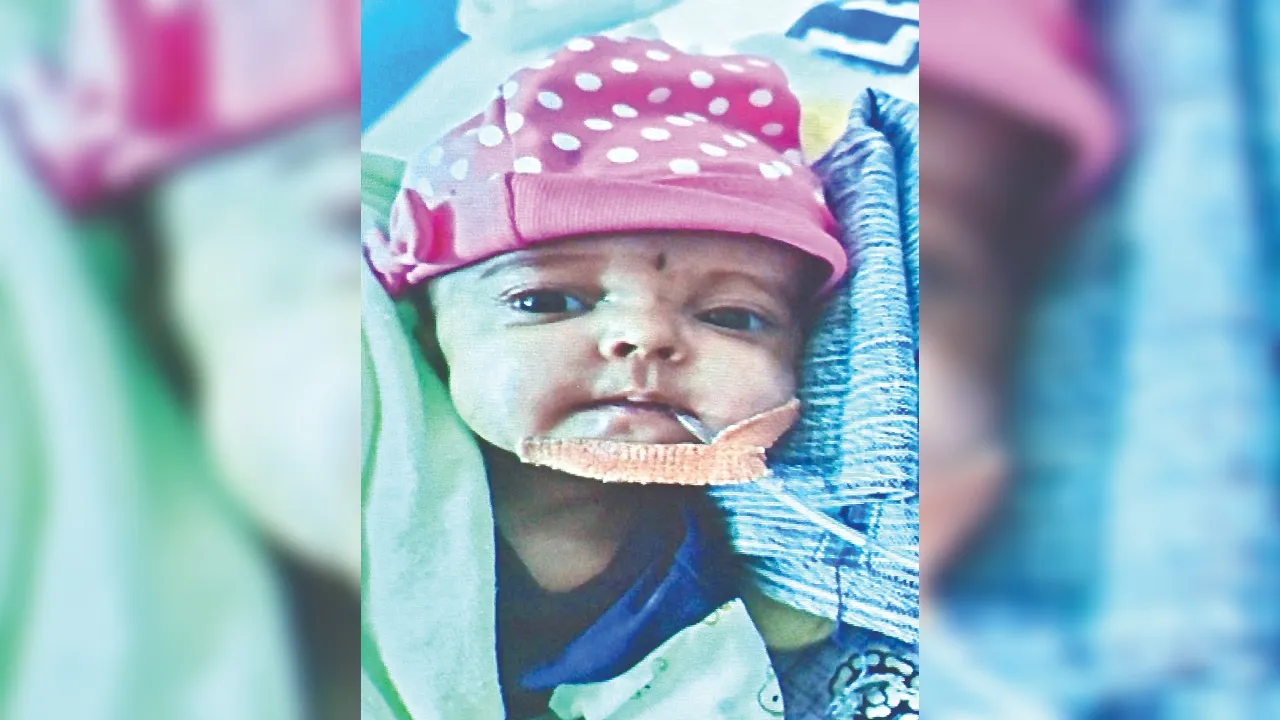 Kanpur: संकट मोचक बने डॉक्टर, बचाई 4 माह की बच्ची की जान, हैलट अस्पताल में बिना ऑपरेशन किया स्वस्थ