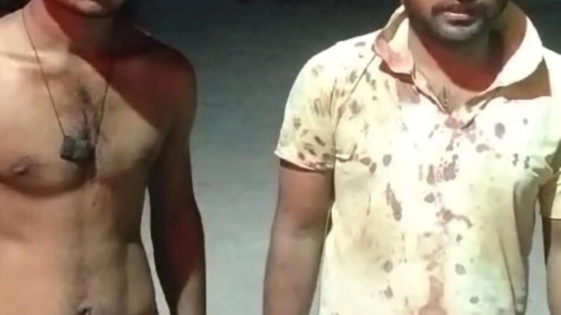 जौनपुर: छेड़खानी का विरोध करने पर दो समुदायों के बीच मारपीट, 2 लोग गंभीर रूप से घायल 