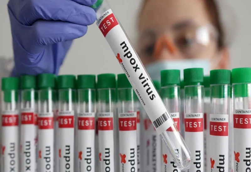 थाईलैंड ने की नए संक्रामक एमपॉक्स स्ट्रेन के पहले मामले की पुष्टि