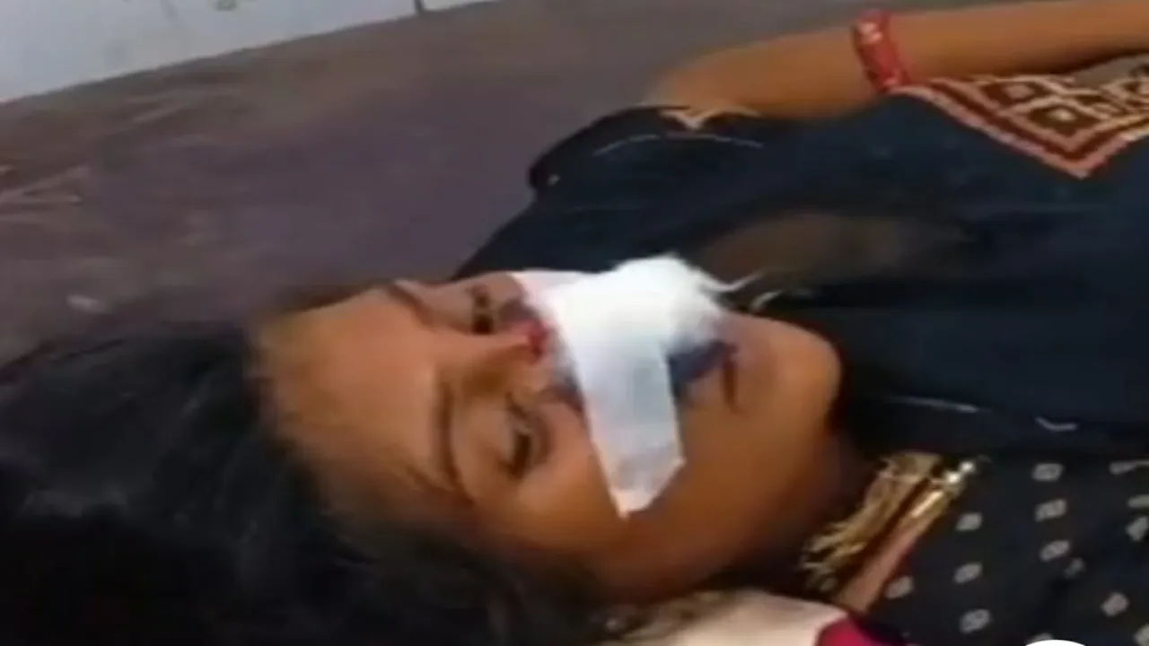हरदोई:  मायके जाने की जिद पर अड़ी महिला की पति ने चबाई नाक