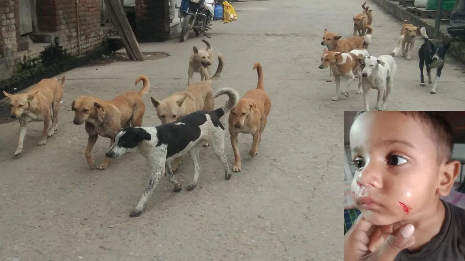 रामपुर:आवारा कुत्ते ने ढाई साल के मासूम को हमला कर किया घायल