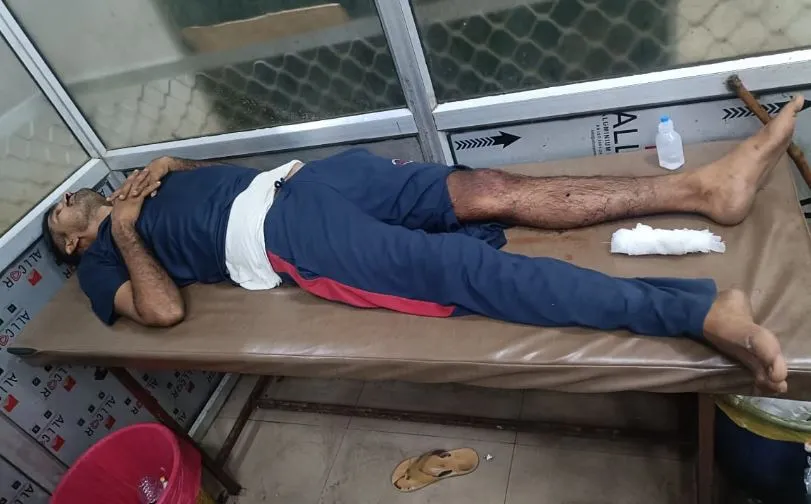 सर्राफा डकैती मामला: मुठभेड़ में तीन बदमाशों को लगी गोली, पुलिस ने दबोचा...एक सिपाही भी घायल 