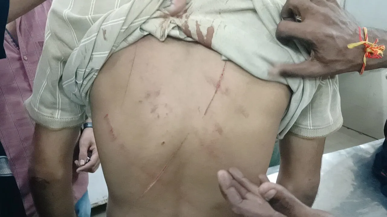 बहराइच: दबंगों ने घर में घुसकर युवक पर किया धारदार हथियार से हमला, 8 के खिलाफ केस दर्ज