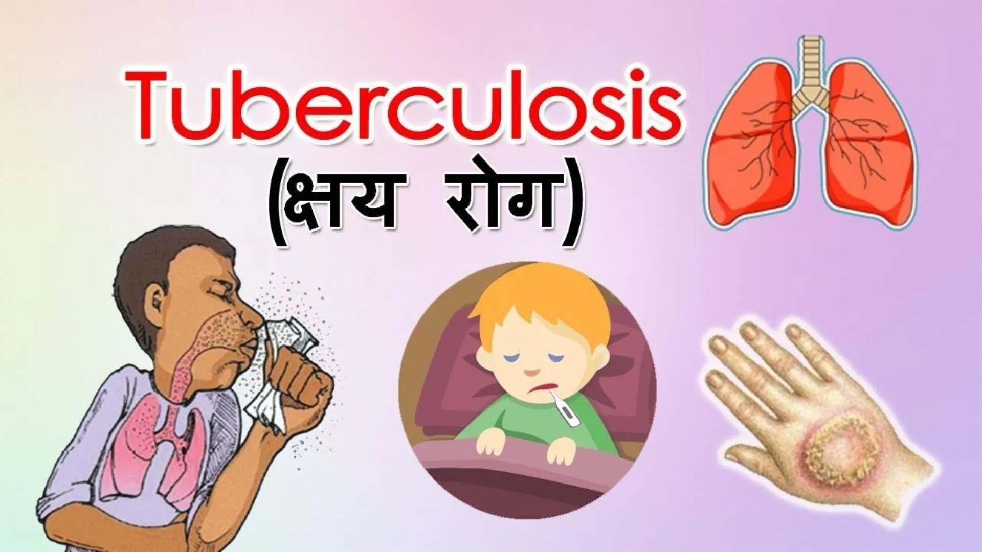 अयोध्या:  क्षय रोगी खोज अभियान में मिले 123 मरीज, इलाज शुरू 