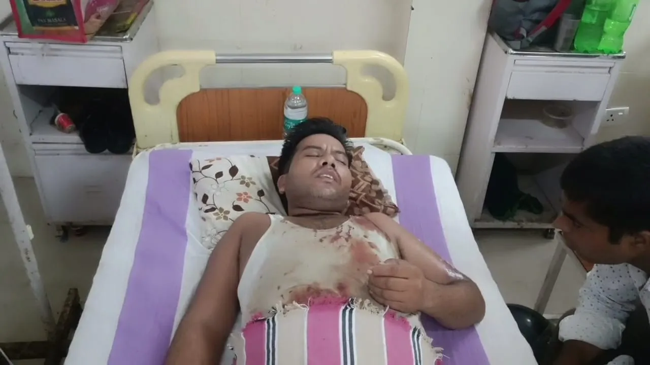 Unnao News: आंधी से मैरिज लॉन की दीवार गिरी...कैटर्स समेत 4 गंभीर घायल