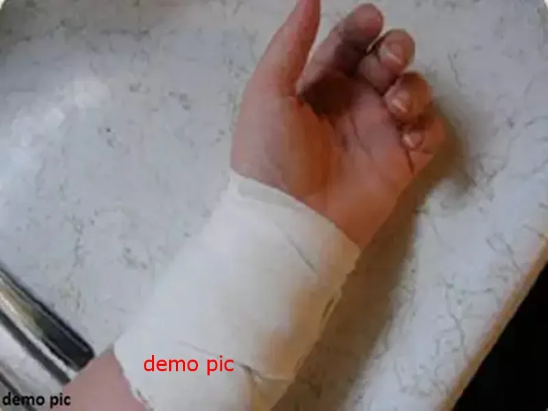 बाजपुर: शादी से मना करने पर युवती ने हाथ की नस काटी