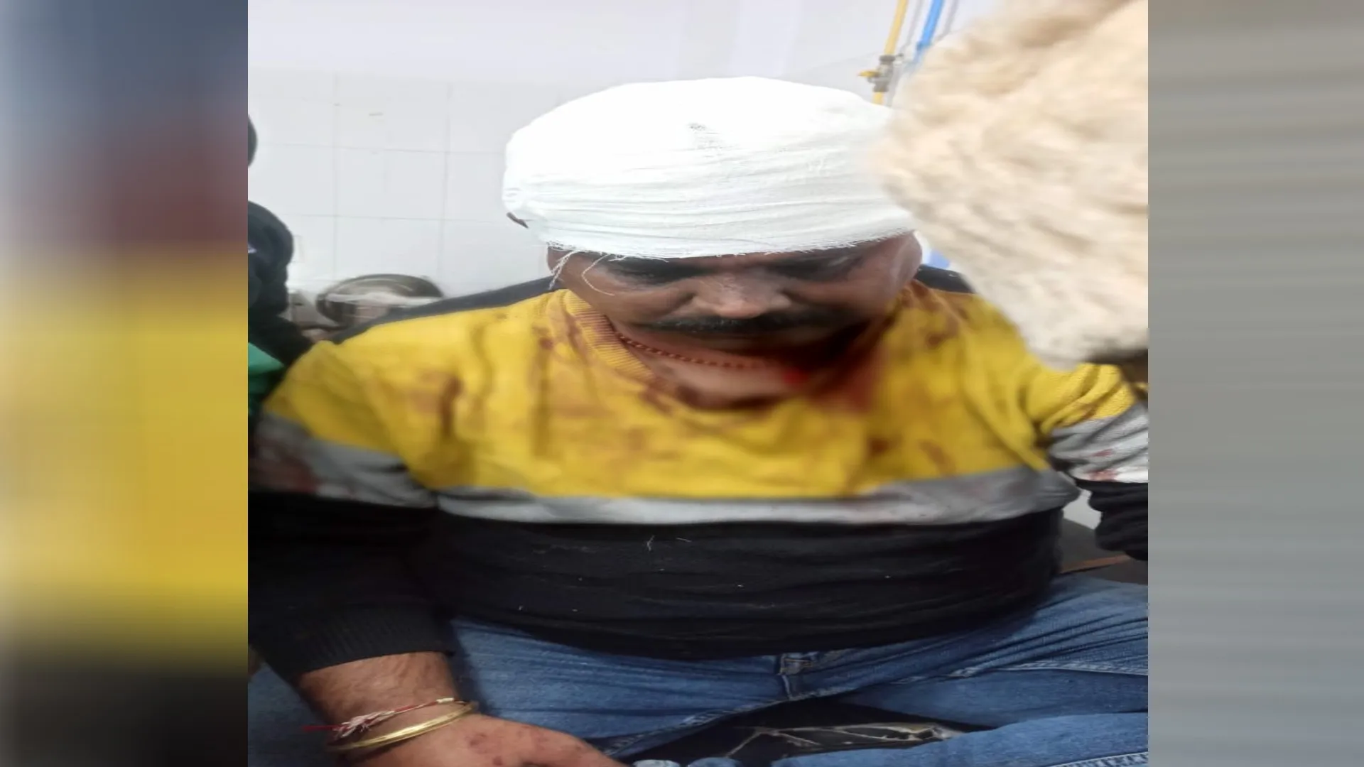 मुरादाबाद: भाजपा के मंडल अध्यक्ष पर 10 से ज्यादा लोगों ने किया जानलेवा हमला